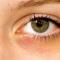 Желтизна под глазами: причины возникновения и особенности лечения