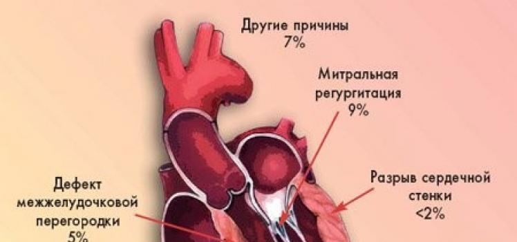 Syok kardiogenik: kejadian dan tanda, diagnosis, terapi, prognosis